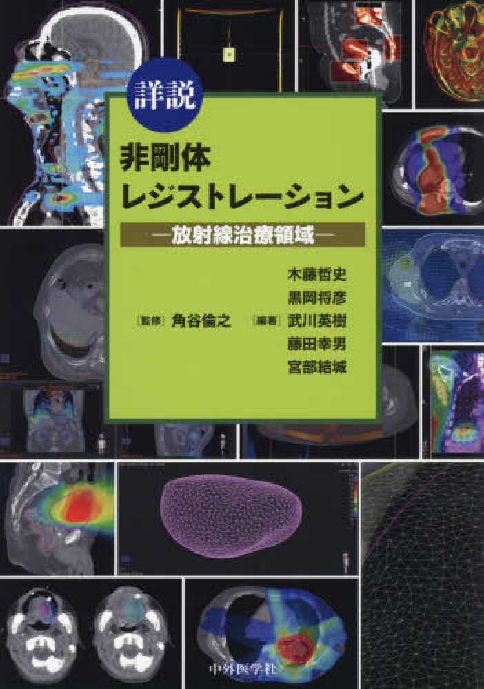 詳説 非剛体レジストレーション―放射線治療領域